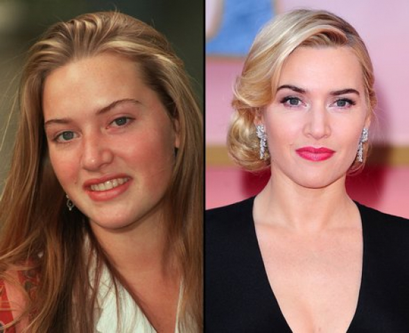 Kate Winslet