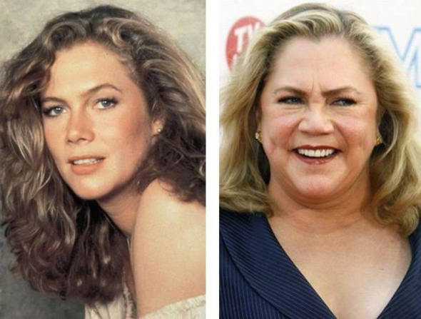 Kathleen Turner