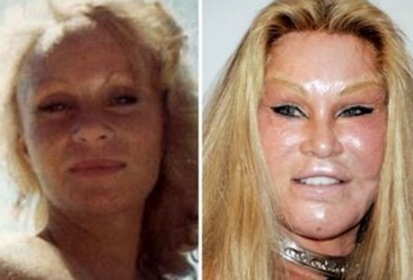 2. Jocelyn Wildenstein